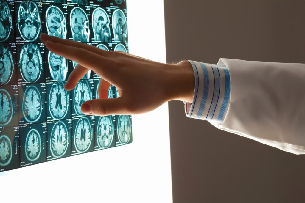 head injury lawyer Bakersfield, CA